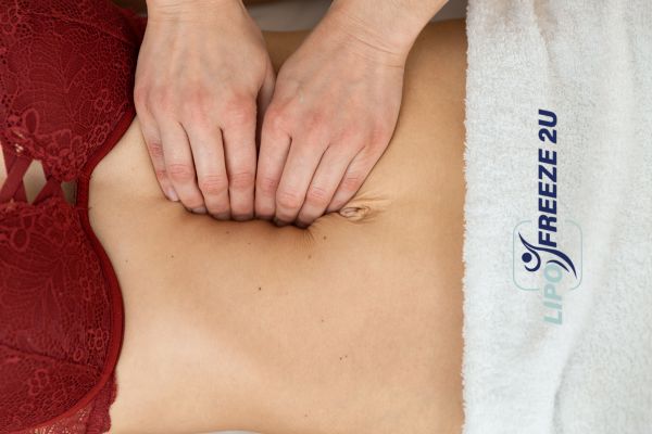 diastasis recti treatment Canary Wharf