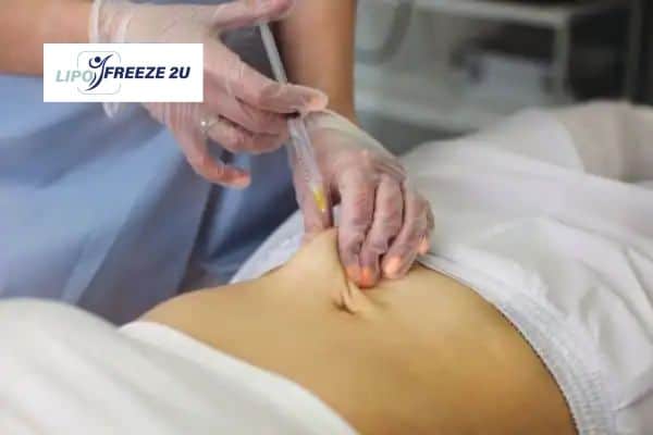 How Does Aqualyx Fat Dissolving Injection Work to Break Down Fat Canary Wharf?