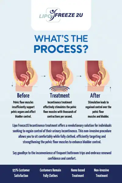 Diagram of how incontinence treatment Canary Wharf works.