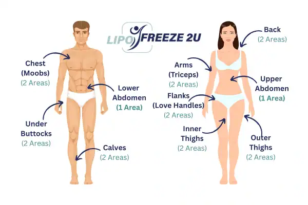 Areas you can have fat freezing treatment Canary Wharf