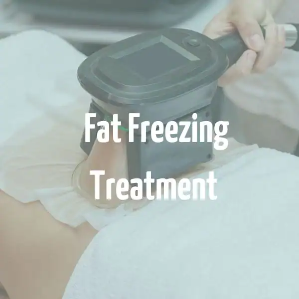 fat freezing treatment Canary Wharf