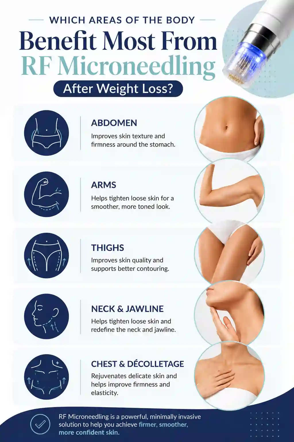 Which Areas of the Body Benefit Most From RF Microneedling After Weight Loss Canary Wharf